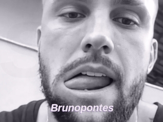 Brunopontes