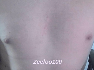 Zeeloo100